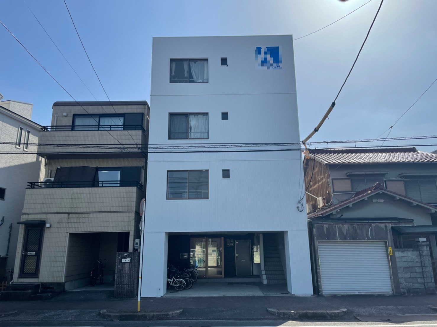 After画像